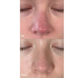 Purifying Mist + Face & Body - rauhoittava hypokloorihapposuihke