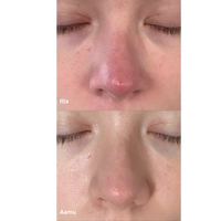 Purifying Mist + Face & Body - rauhoittava hypokloorihapposuihke