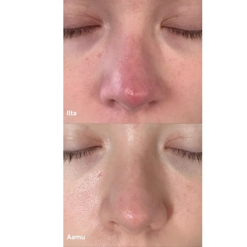Purifying Mist + Face & Body - rauhoittava hypokloorihapposuihke